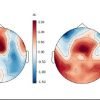 This shows an EEG diagram from the study