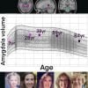 This shows a growth chart, brain scans, and the faces of females at different ages from childhood to old age