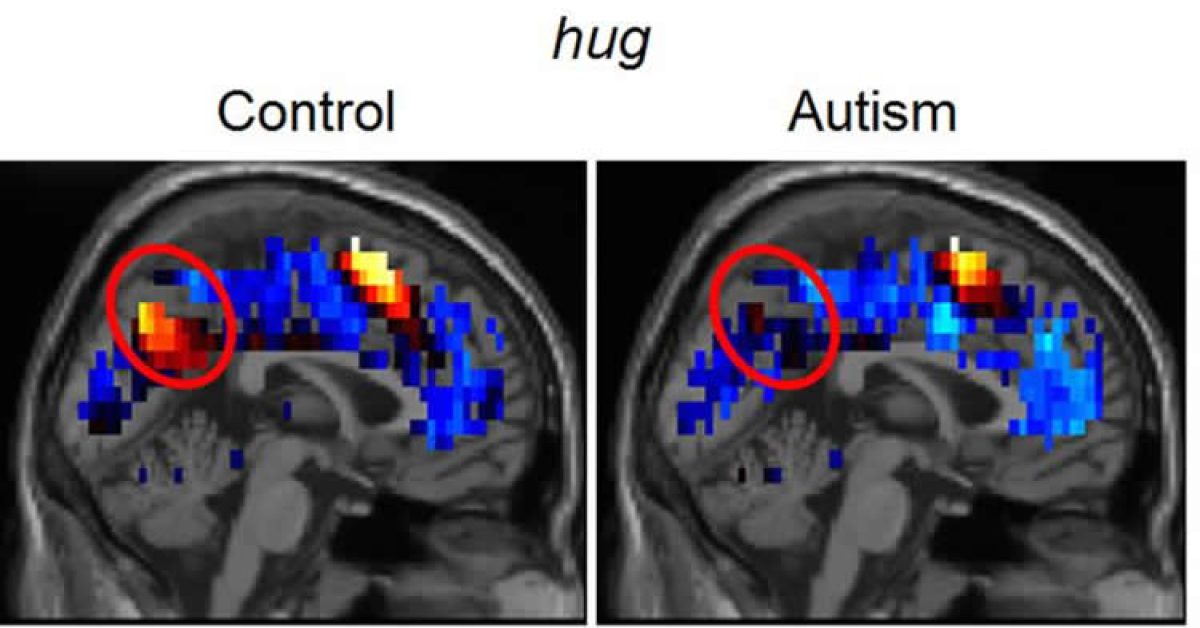 mri-autism-social-interaction1.jpg