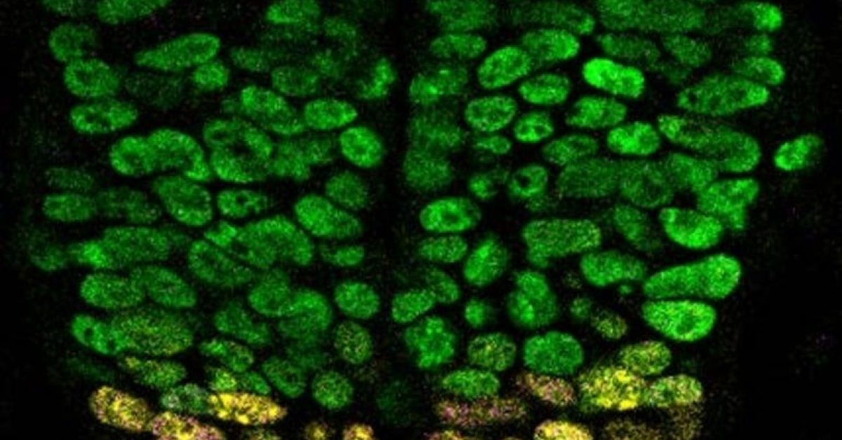 cannabis-birth-defect-neurosicens.jpg