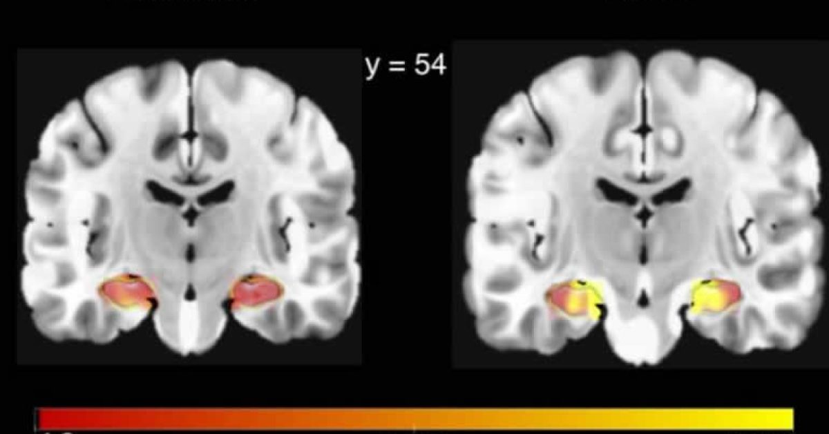 cbd-hippocampus-blood-flow-neuroscienews.jpg